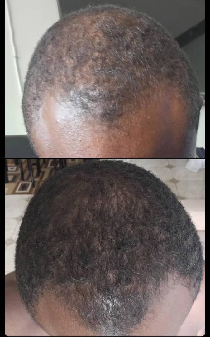 Résultats Avant / Après Shampoing et Duo